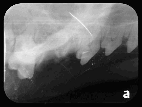 Yuki's Oral Cavity Radiographs