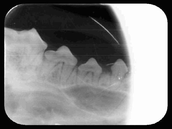 Yuki's Oral Cavity Radiographs