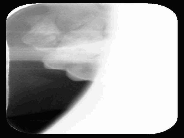 Yuki's Oral Cavity Radiographs