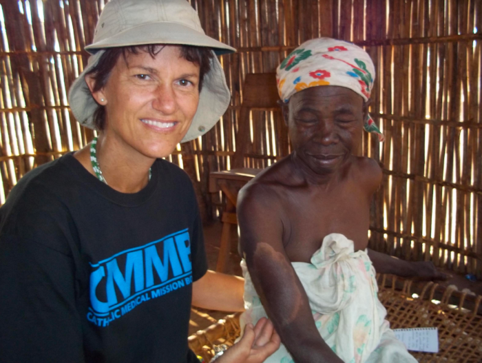 Katie with Linda, with first spot of leprosy on her arm (Katie Gesto)