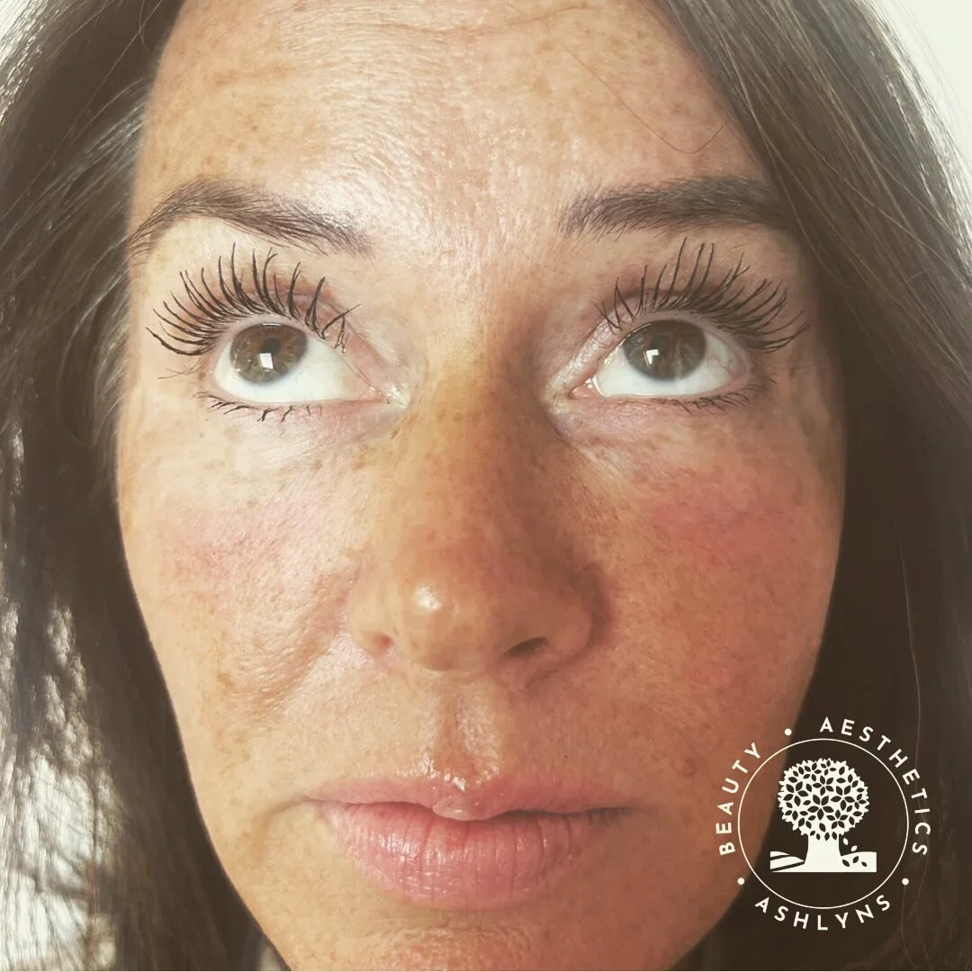 Home Hair Removal vs Clinic Laser Hair Removal Which is better