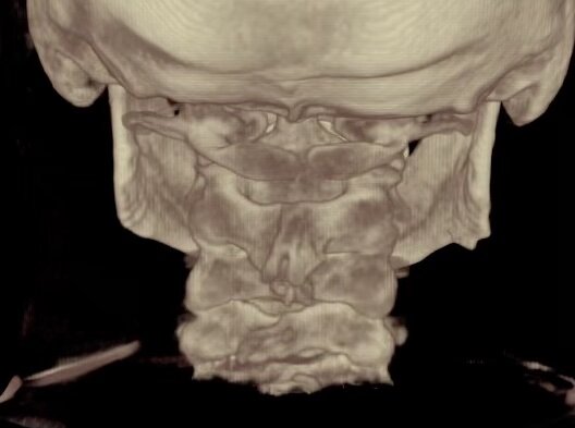 CBCT screenshot.jpg