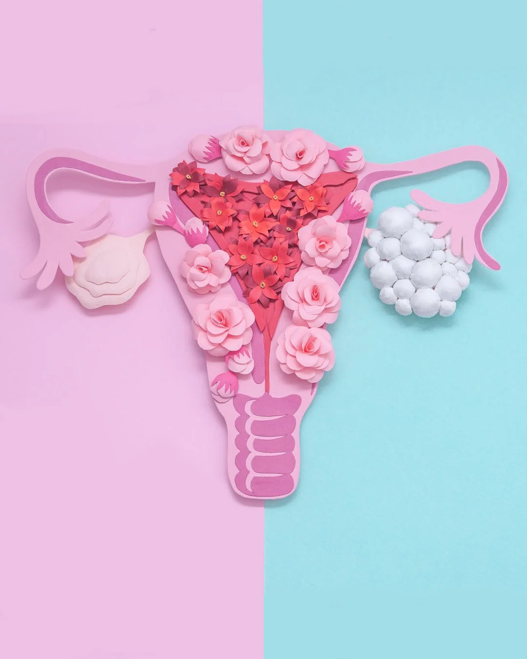 PCOS Gets a New Name - Part 1