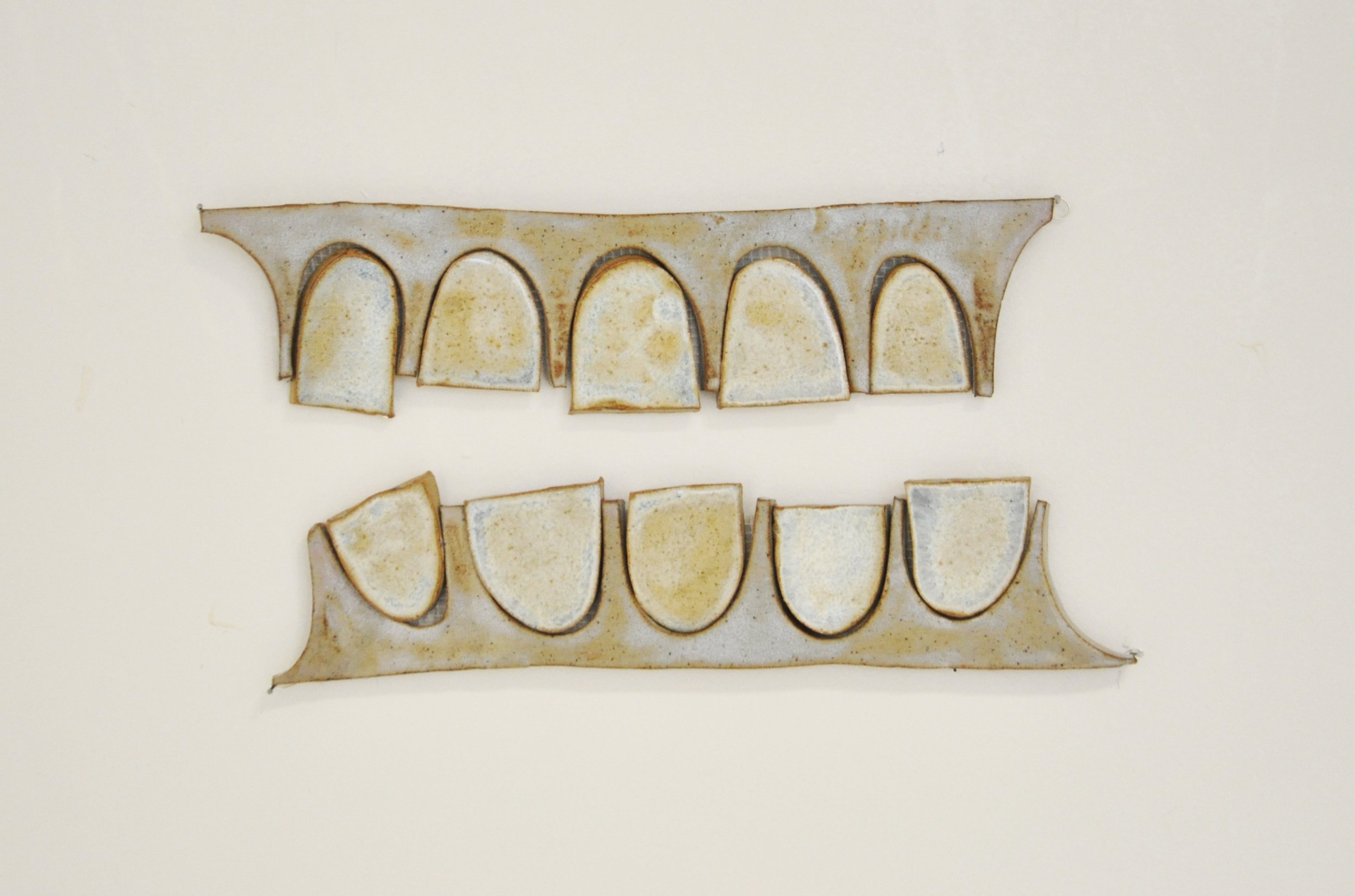 ceramic teeth 5.jpg