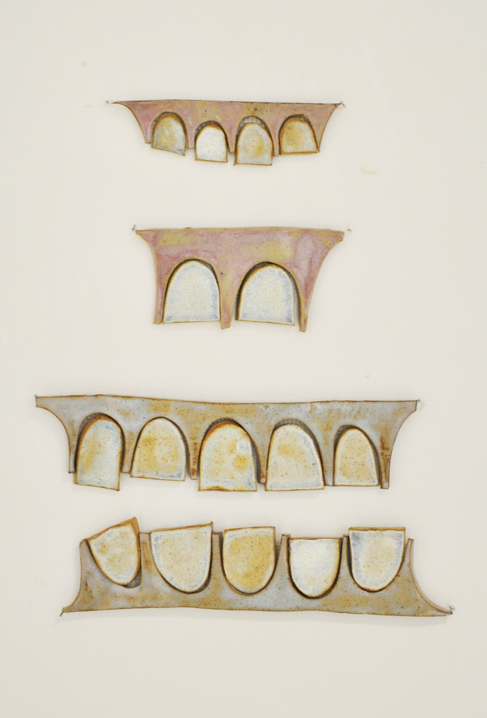 ceramic teeth1.jpg