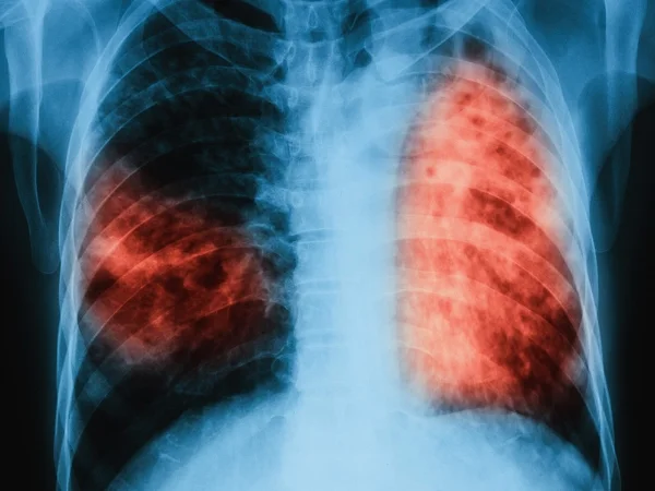https://www.medscape.com/viewarticle/848709