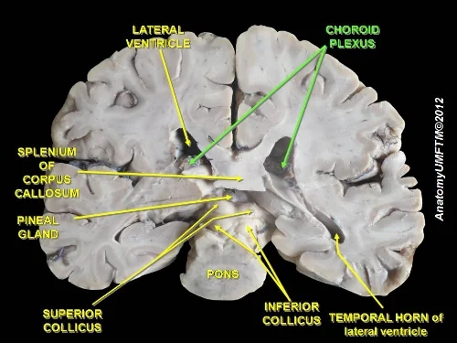 What is the function of the choroid plexus? — Brain Stuff