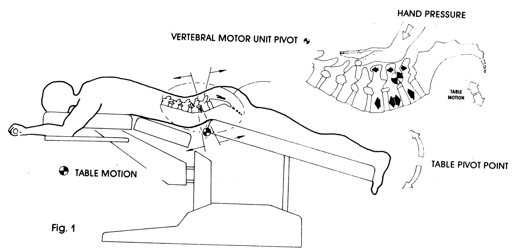 Flexion Distraction Therapy