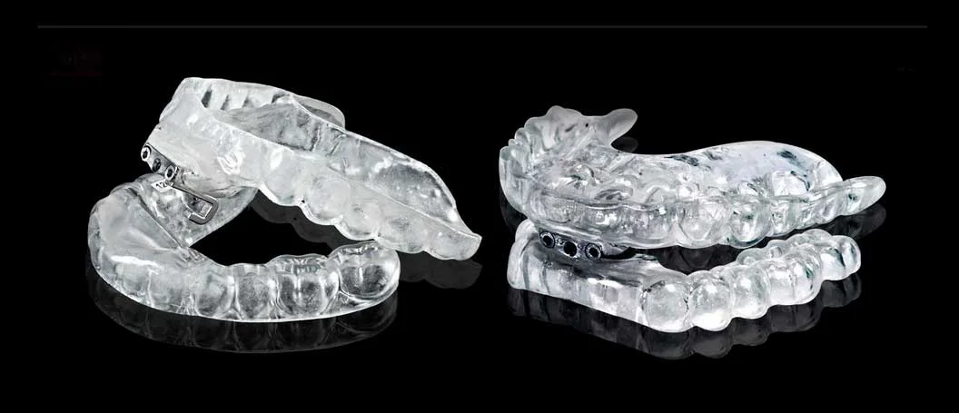 Figure 2: The TAP Appliance. The TAP appliance is a custom-made, two-piece appliance that snaps firmly and comfortably over the upper and lower teeth, much like a sports mouthguard or retainer. Its basic function is to hold the jaw forward so the tongue and soft tissues of the throat do not collapse into the throat causing snoring and sleep apnea.