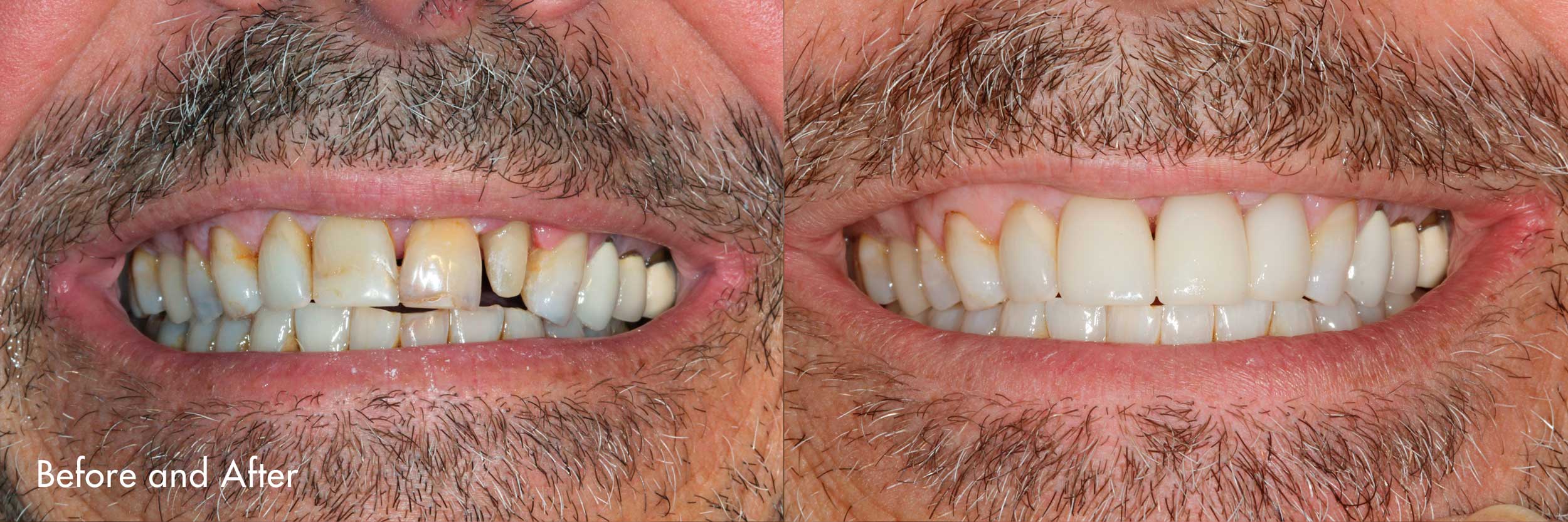 MustacheBefore+After.jpg