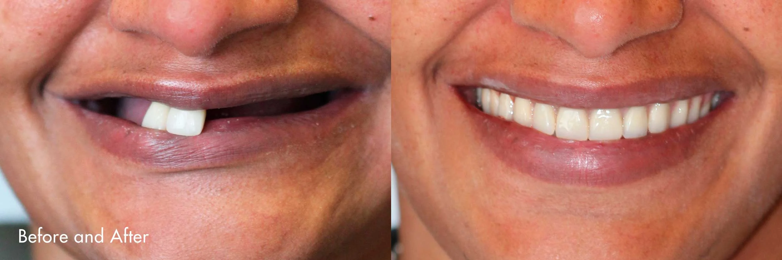 Smiles created by Dr. Sidi.