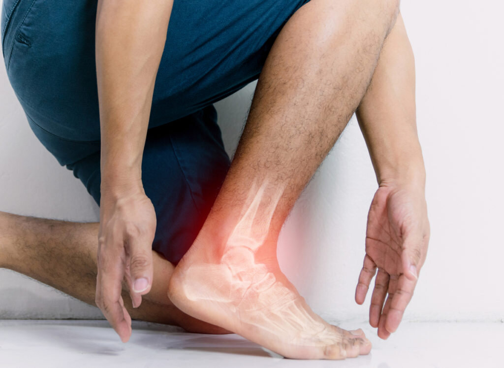 Ankle Pain Without Injury Melbourne Physio Clinic & Fitness