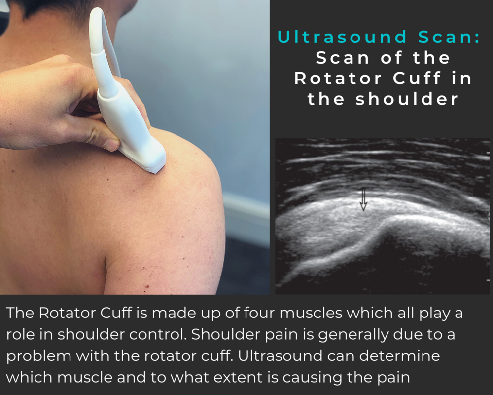 Ultrasound — LB Physio