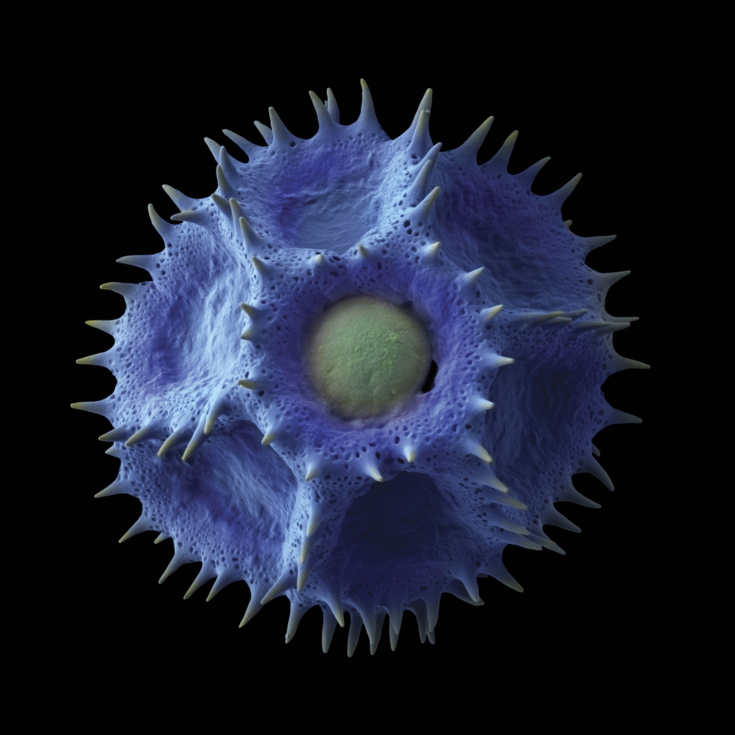 KesselerRob_Chicory pollen grain.jpg
