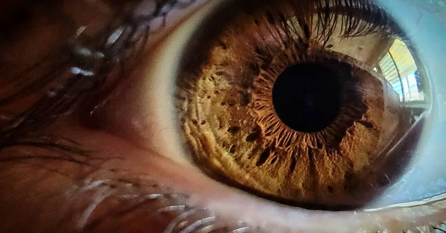 Phone cameras have gotten ridiculous. This thing has a macro lens.