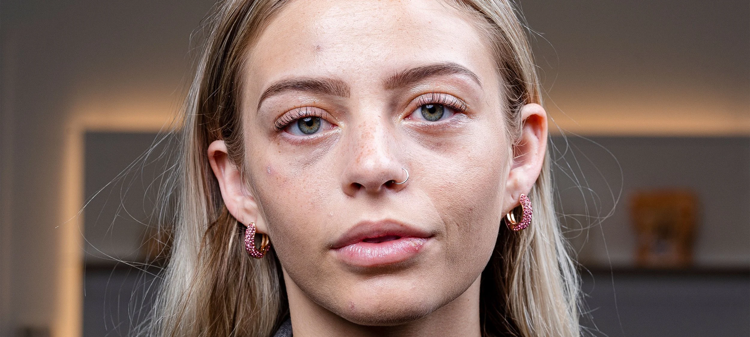 Eyedolize_After_01.jpg