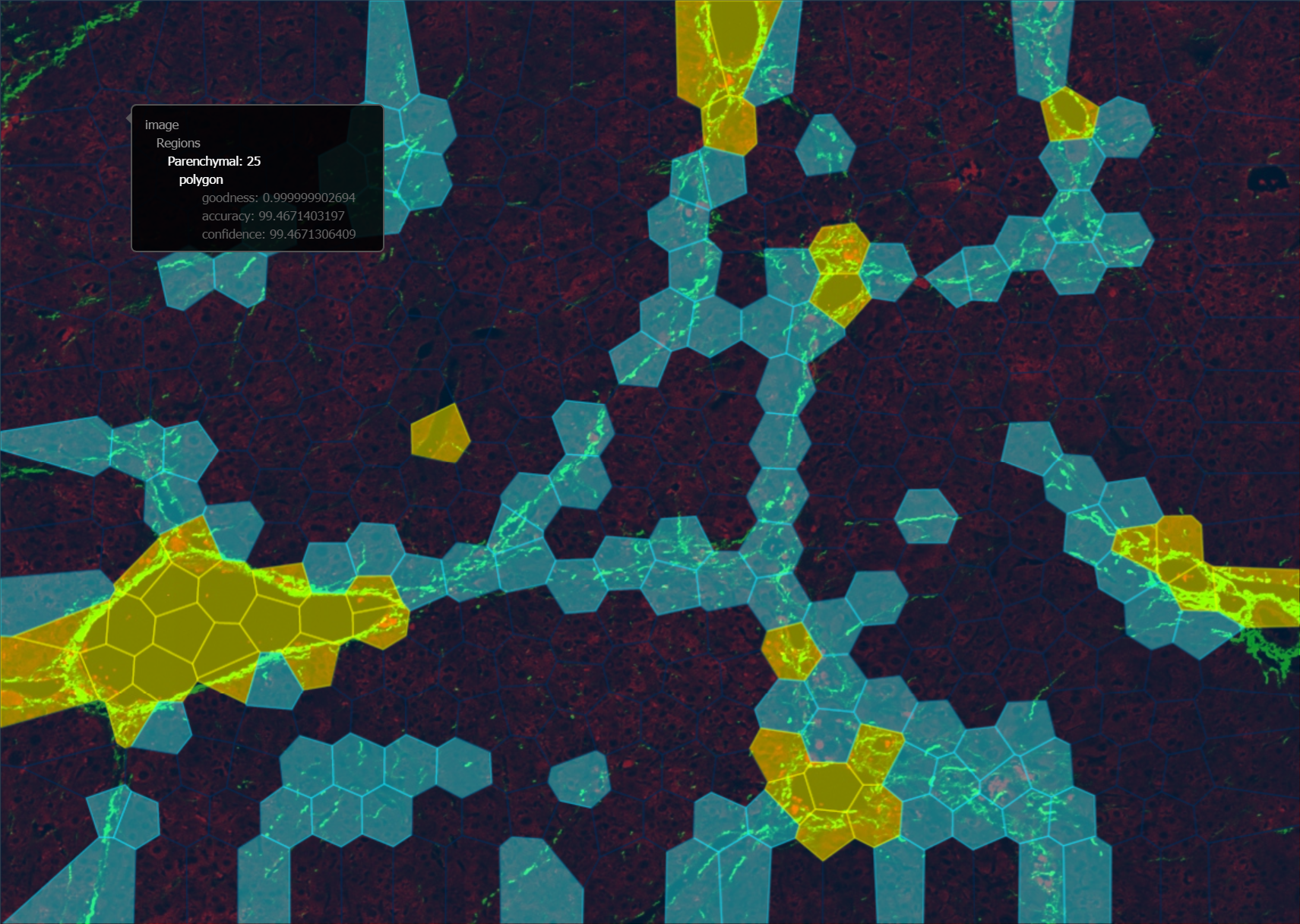 PMK-172_CROP_DL_partitioning-12558.png