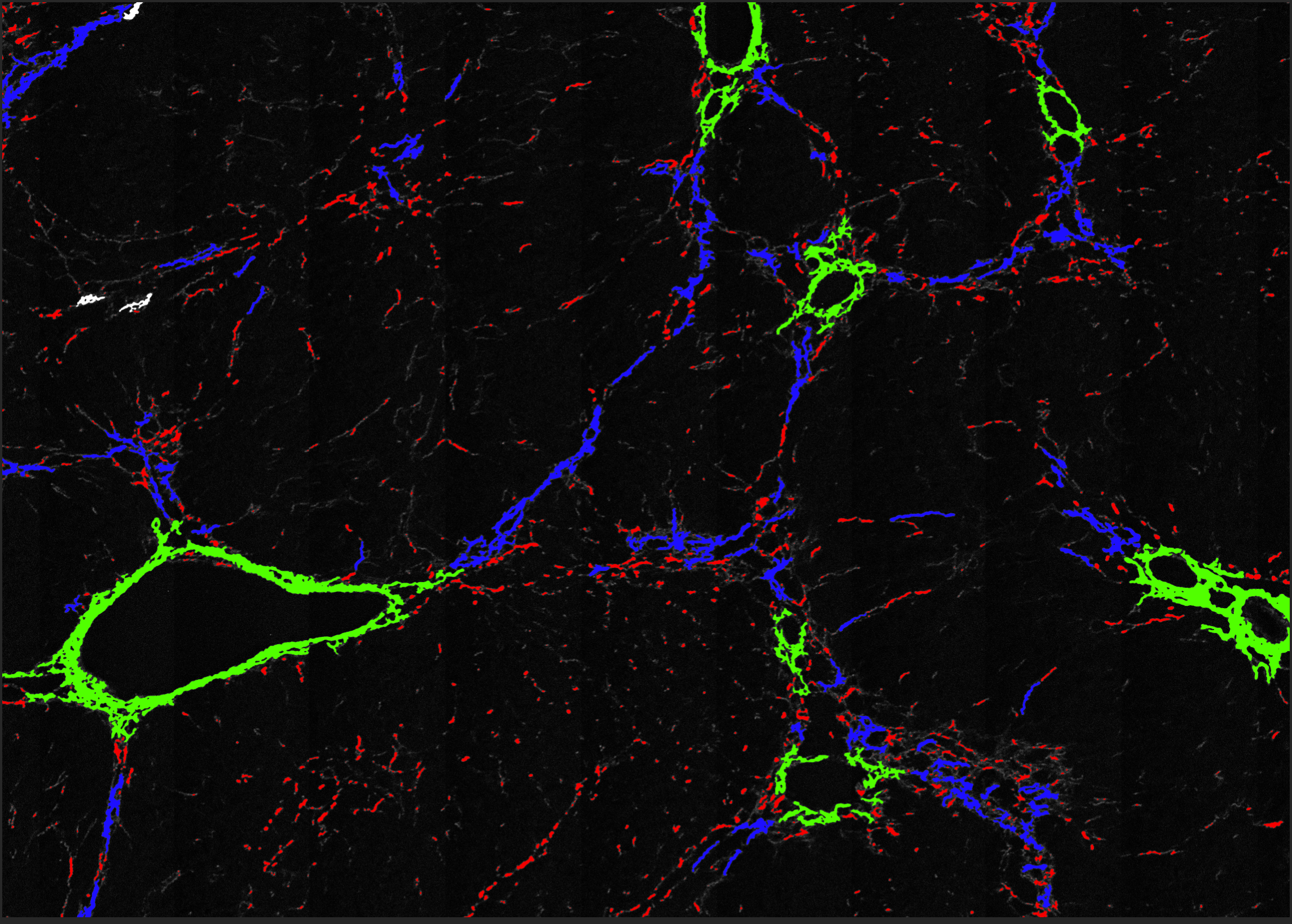 PMK-172_CROP_ch2_DL_classified-12562.png