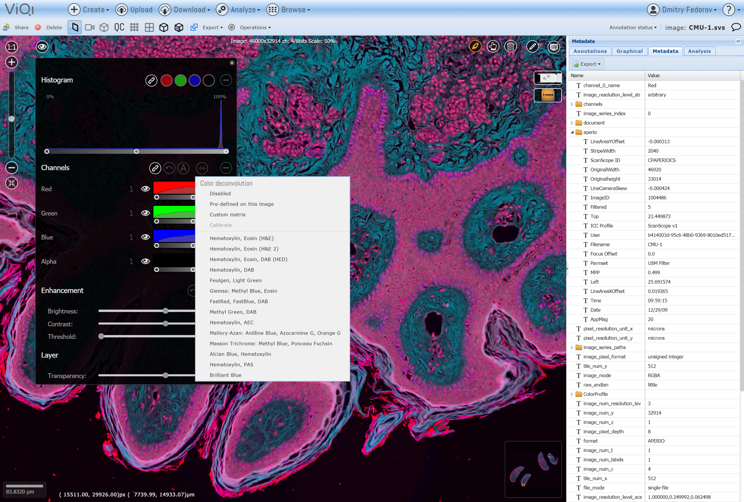 Color deconvolution for Histology