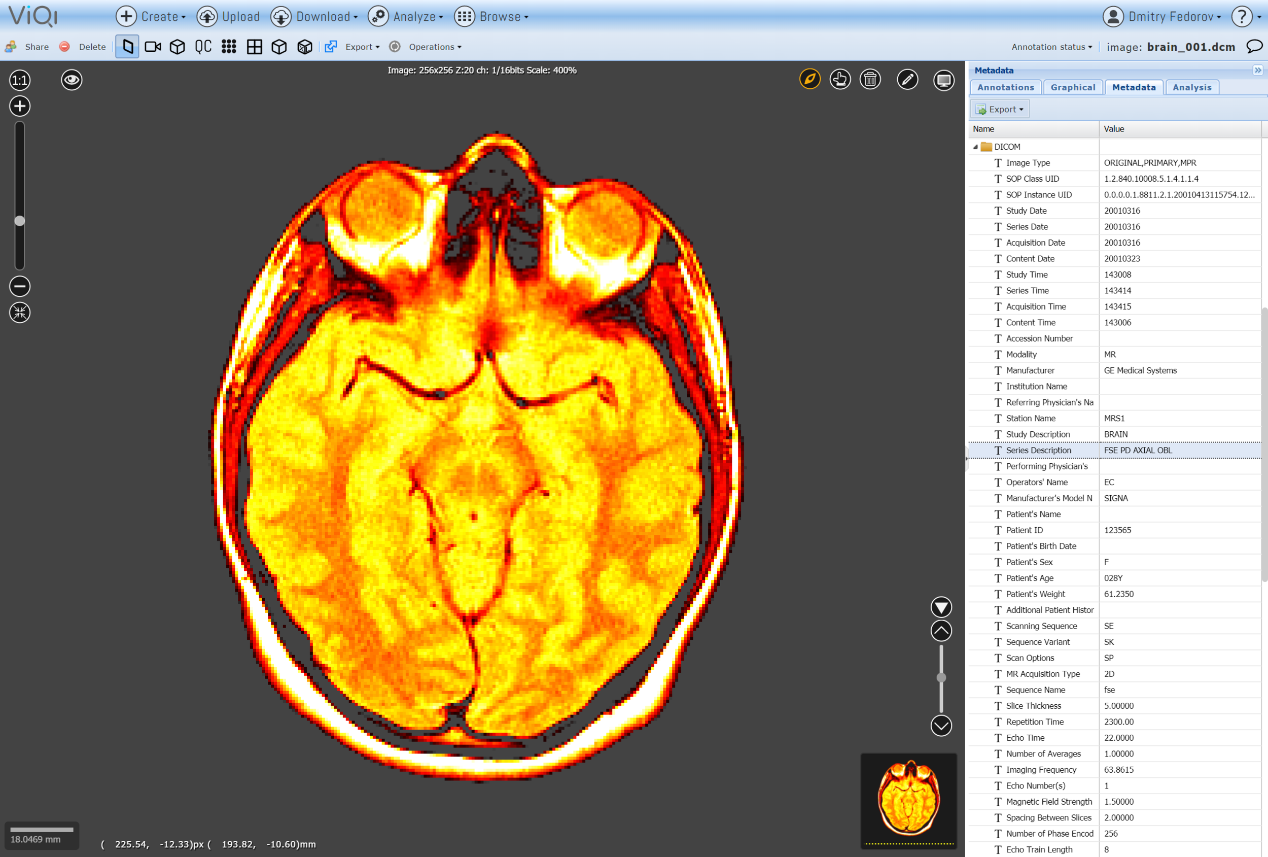 Full DICOM support