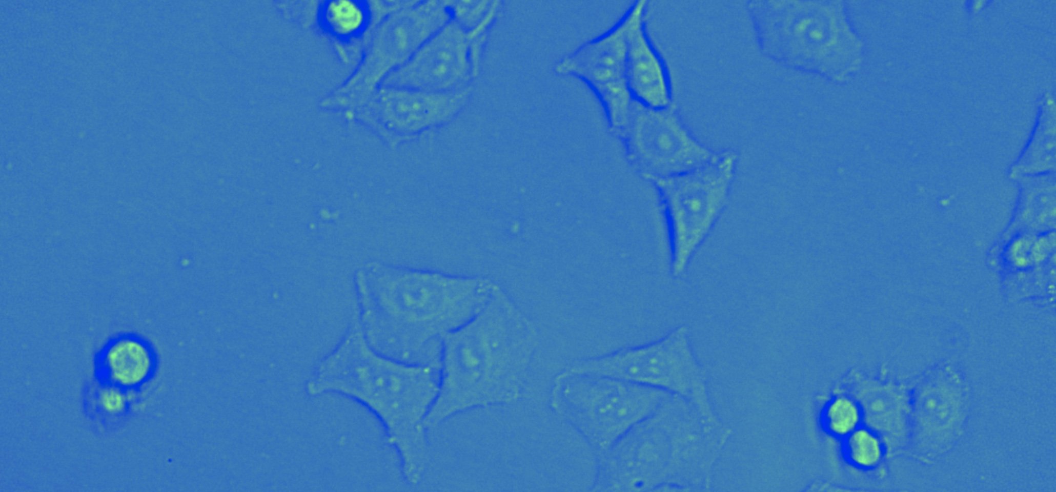 NEW AVIA Automated Viral Infectivity Assay