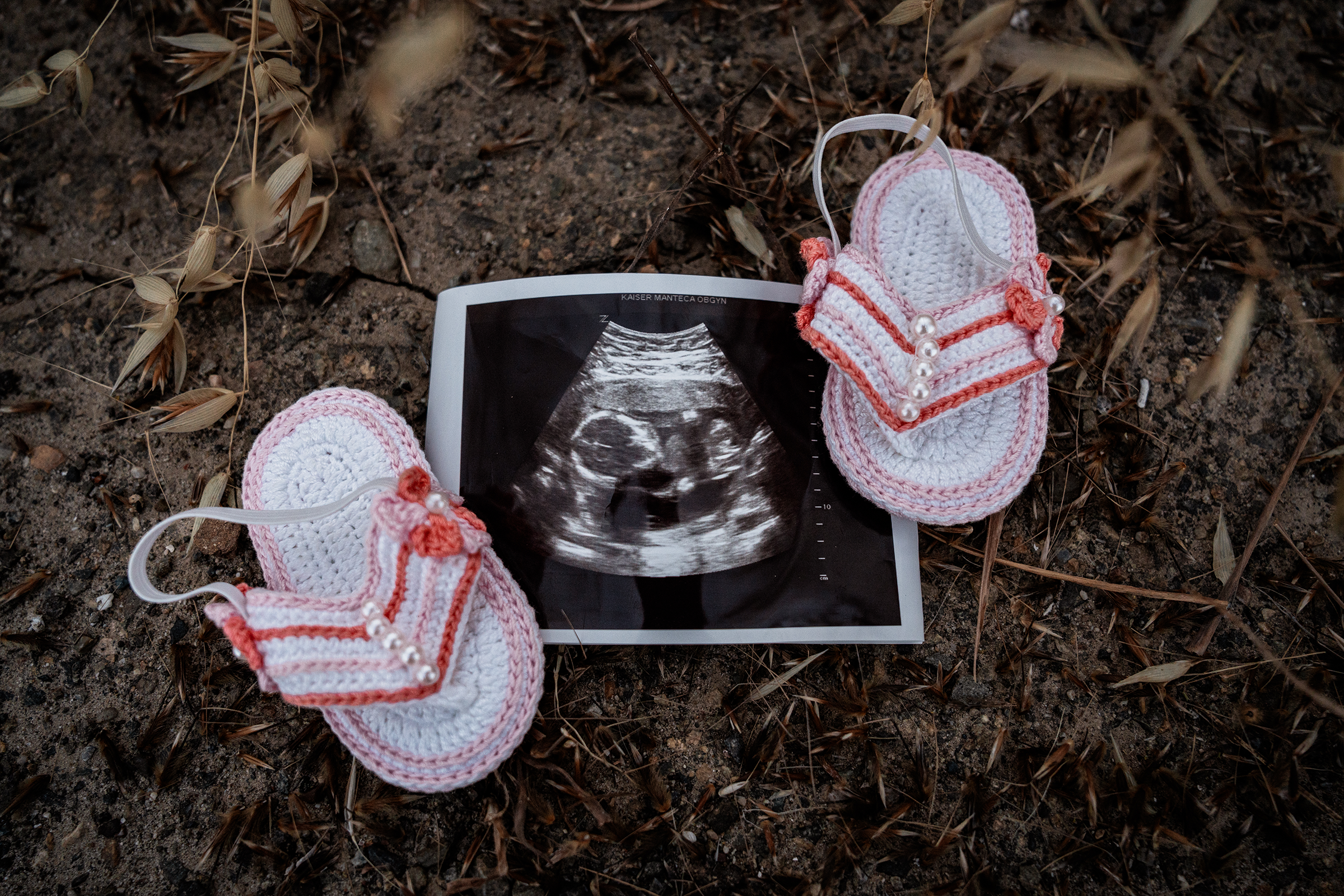 Detail shot of handmade baby shoes with an ultrasound in an open field. Photo taken in Patterson, CA by Mikaela Tosta Photography.