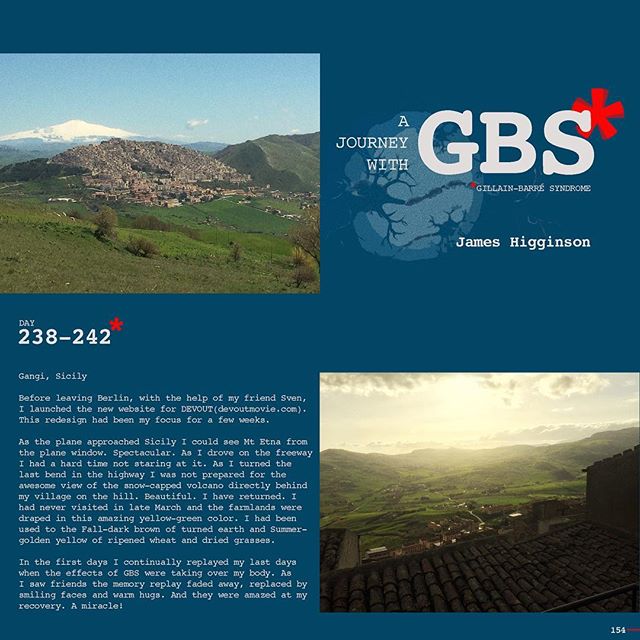 Day 238-242: A Journey with GBS, my journey, are daily posts to share my navigation through this insidious disease. I hope to raise awareness of GBS and add to a dialogue of the syndrome while documenting my recovery. JOIN ME, Follow me on Instagram 