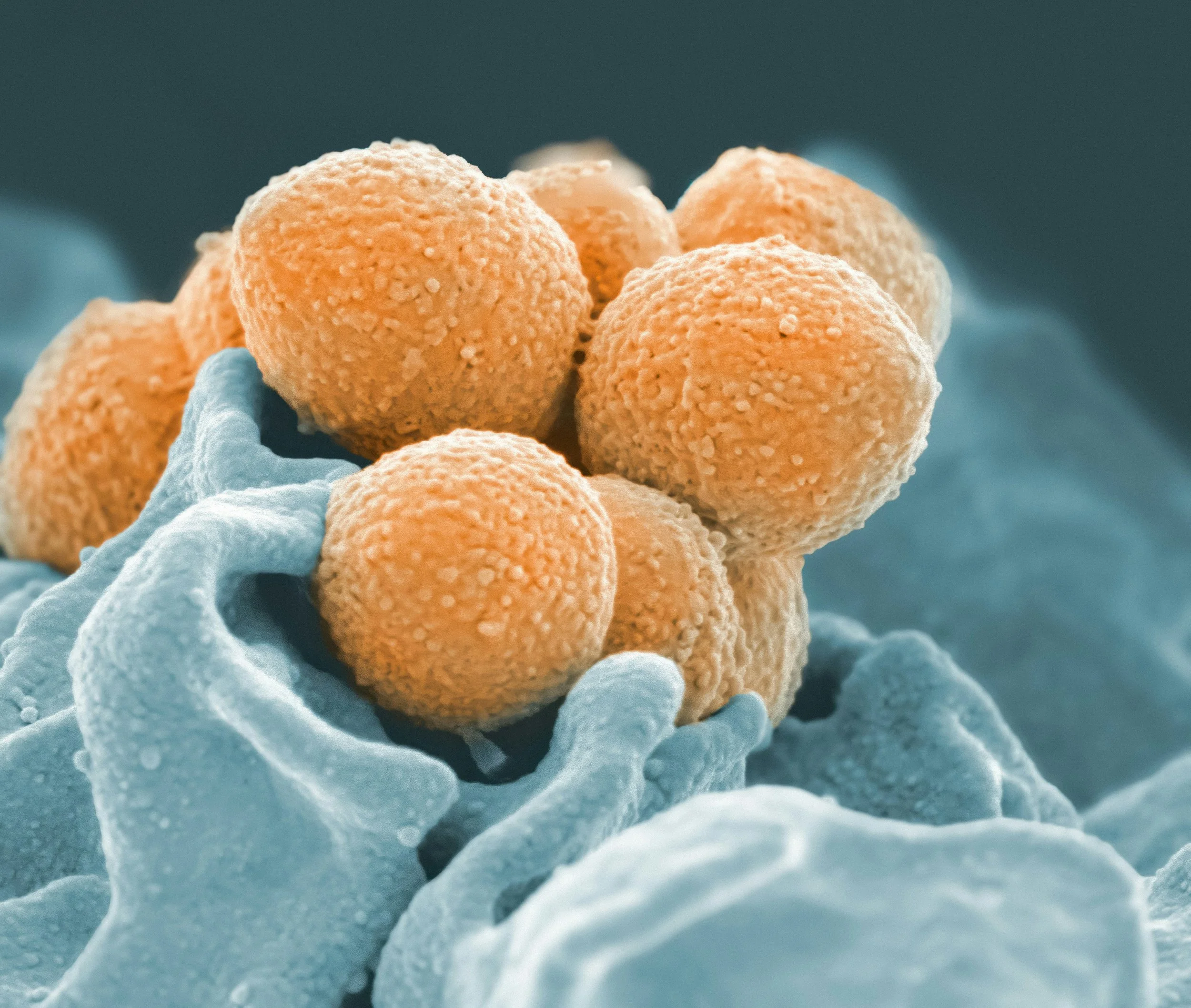 Systemic candida: real or imagined?