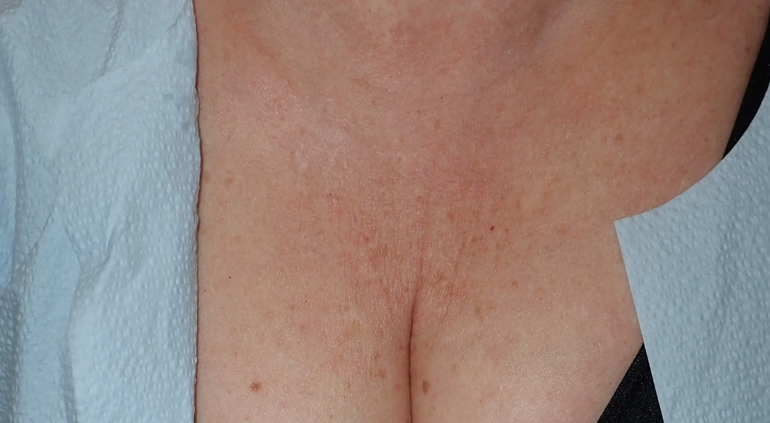 Sculptra Model SSco.jpeg