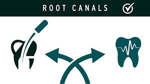 Root Canals Online Course