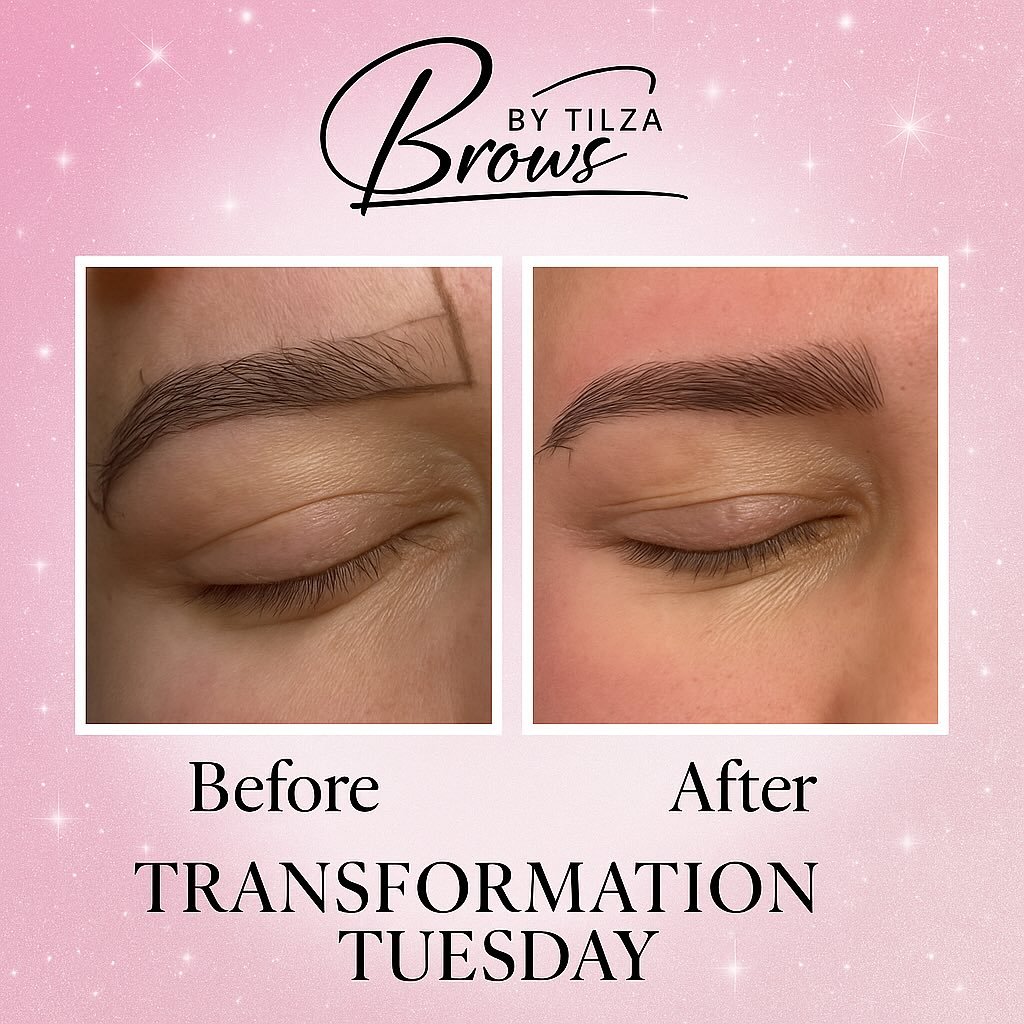 Microblading correction for this beauty!! #Microblading #BrowsByTilza #CoralGablesBrows #BrowTransformation #FeatheredBrows #BrowGoals #NaturalBrows #MicrobladingExpert #BrowArtist #BrowGameStrong #FluffyBrows #EyebrowTattoo #BrowsOnPoint #BrowQueen 
