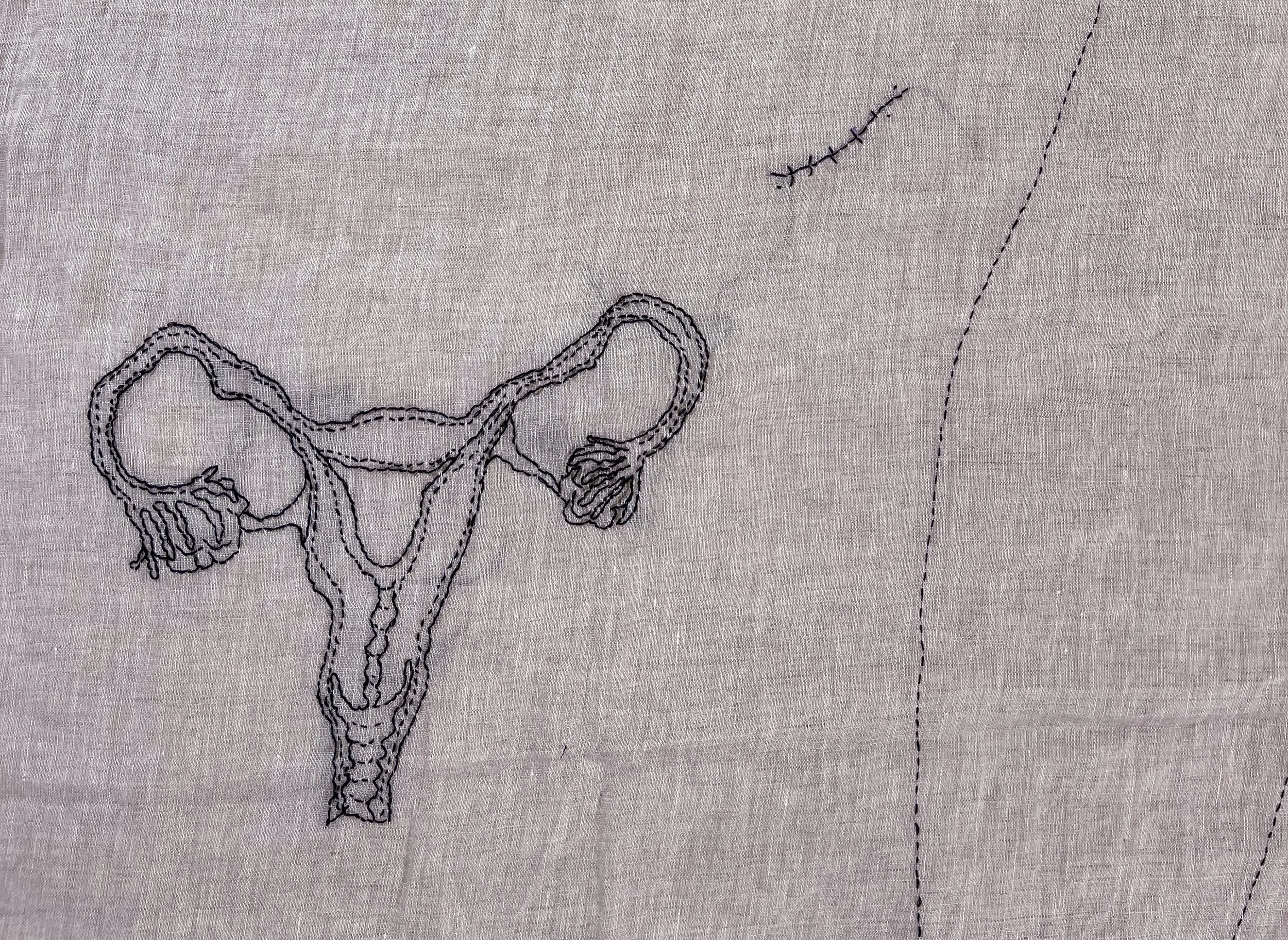 ABSENCE CROP BITS  copy.jpg