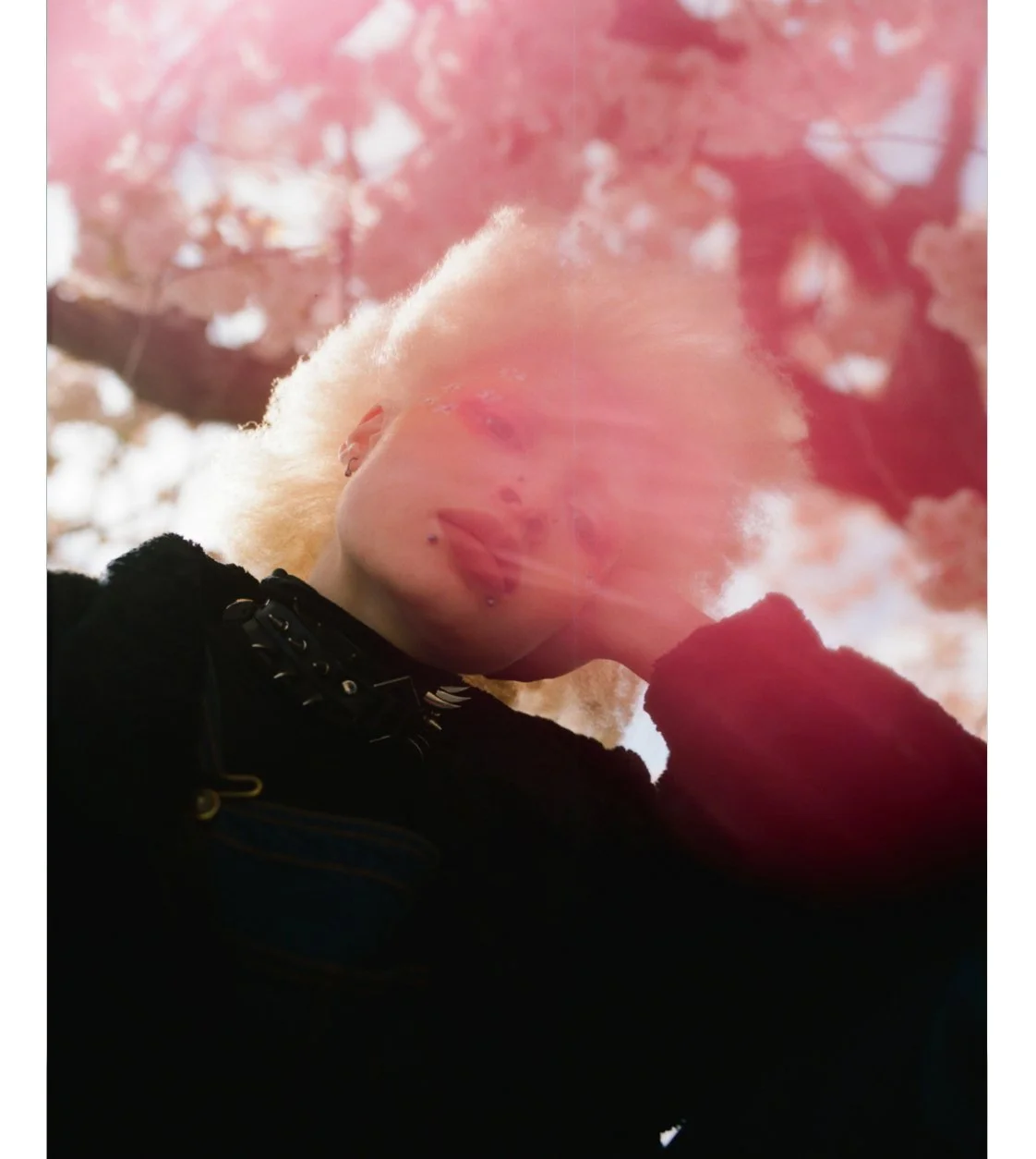 albinism_web.jpg