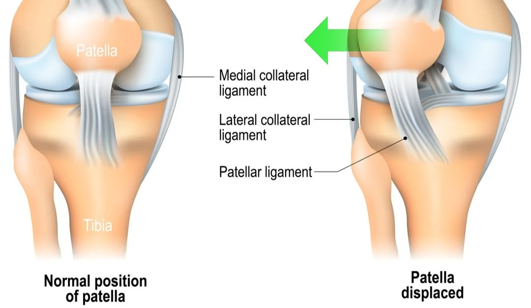 patella