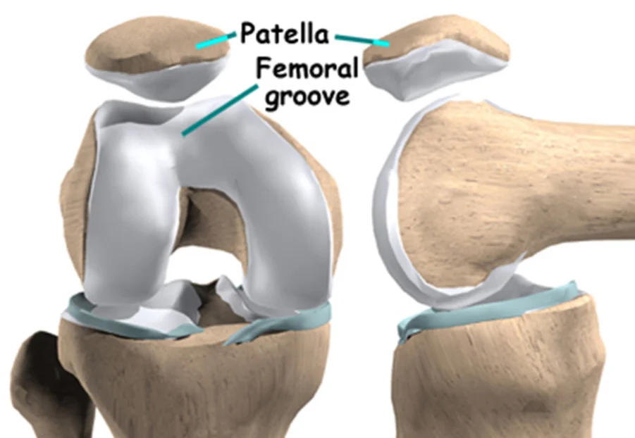 \"patella