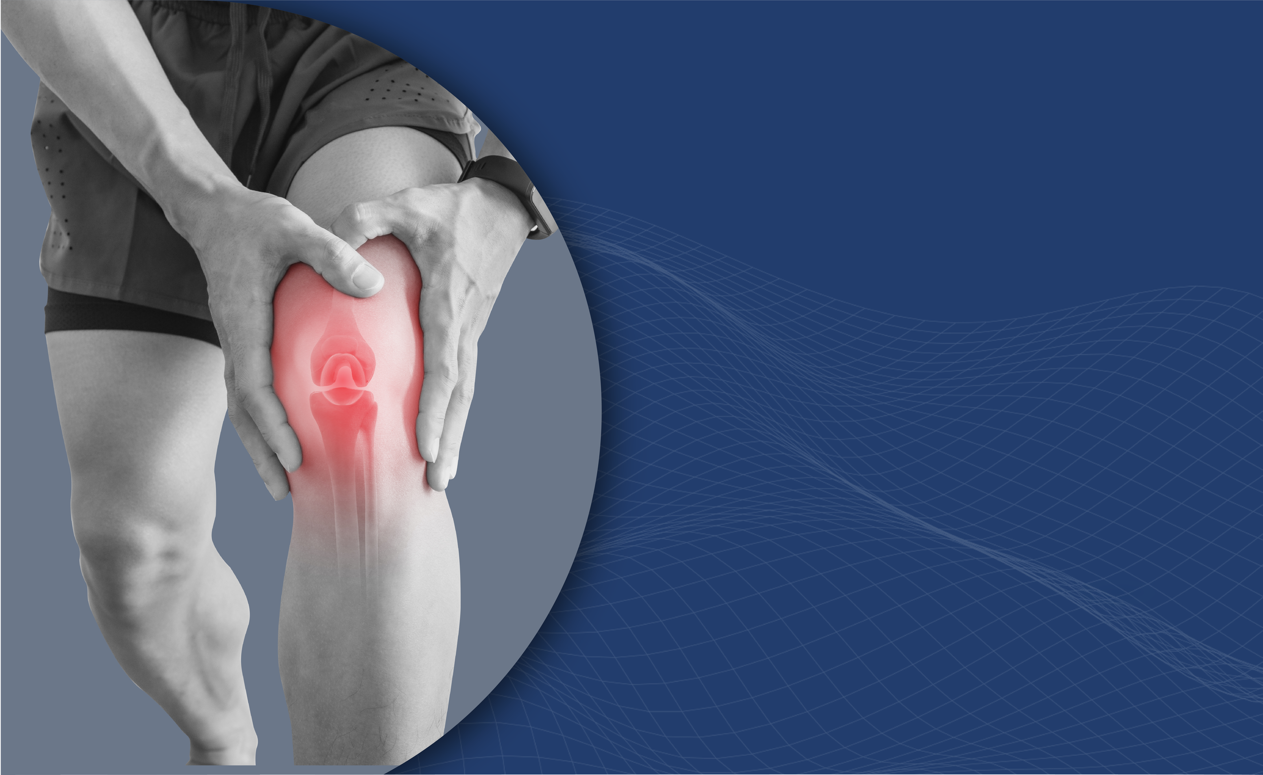 — Knee Pain