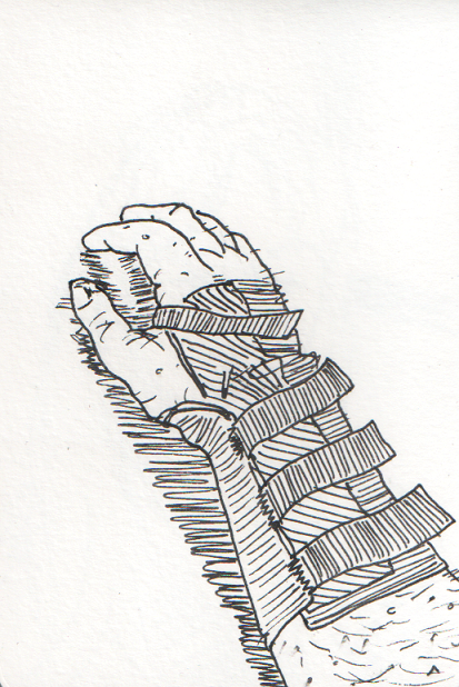 "Wrist Fracture Study"