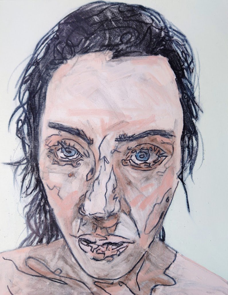 'Amy Study' in early stages