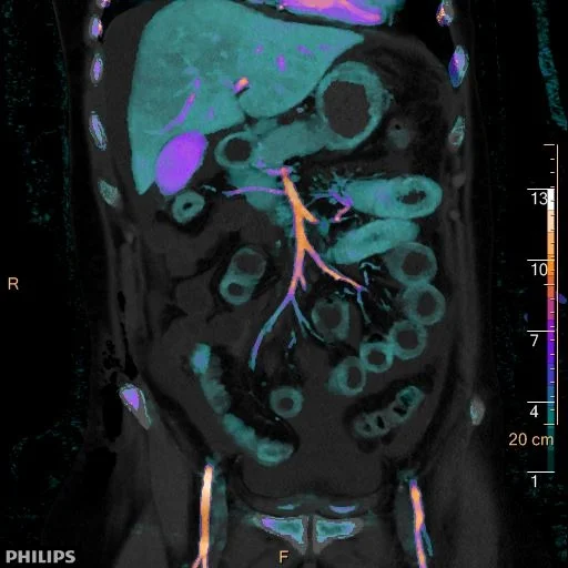 Small Bowel injury