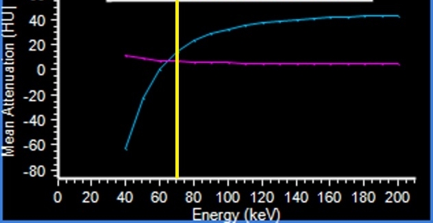 Spectral curves show the density of gallstone and bile is nearly identical at 70 keV (yellow line), but diverges at higher and lower keV