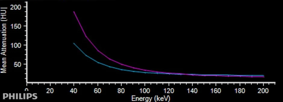 Attenuation curve of adenoma (magenta) and lymph node (blue) are quite different
