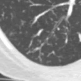 Detail view shows "tree-in-bud" opacity 