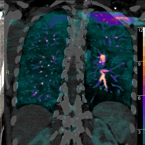 Euler-Liljestrand mechanism