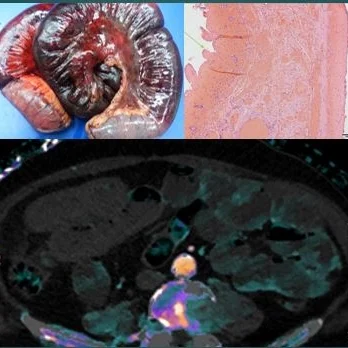 Imaging 3.0: How spectral CT can help