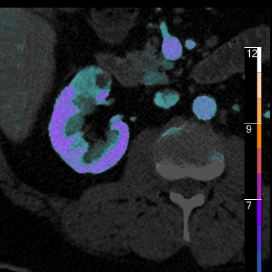 Renal lesions made easy!
