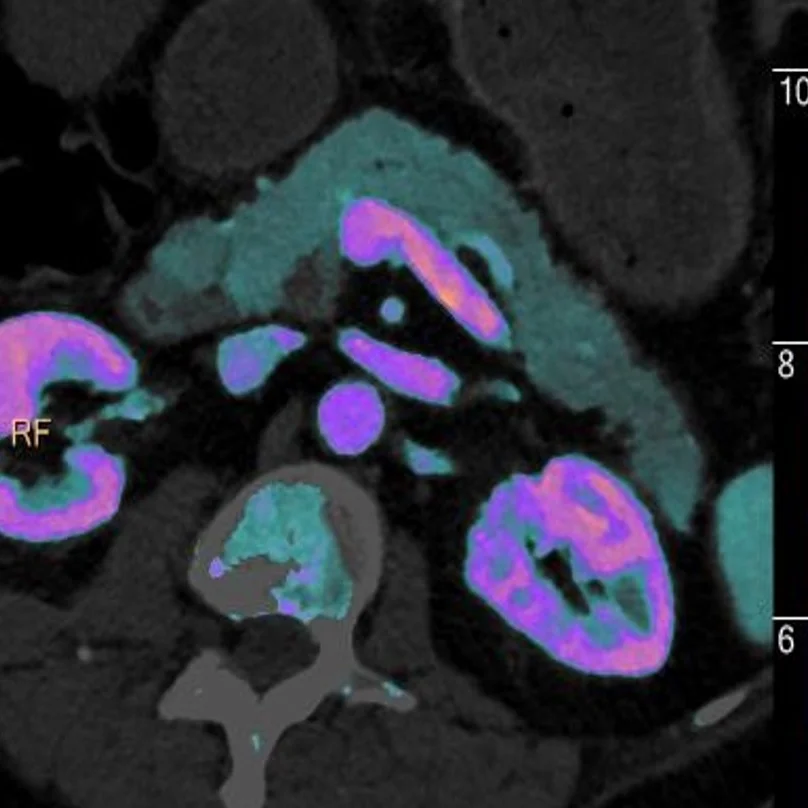 What kind of scan would you want?