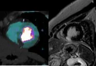 Let us solve this one...