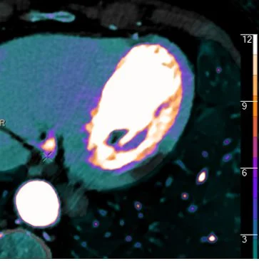 It's all about confidence