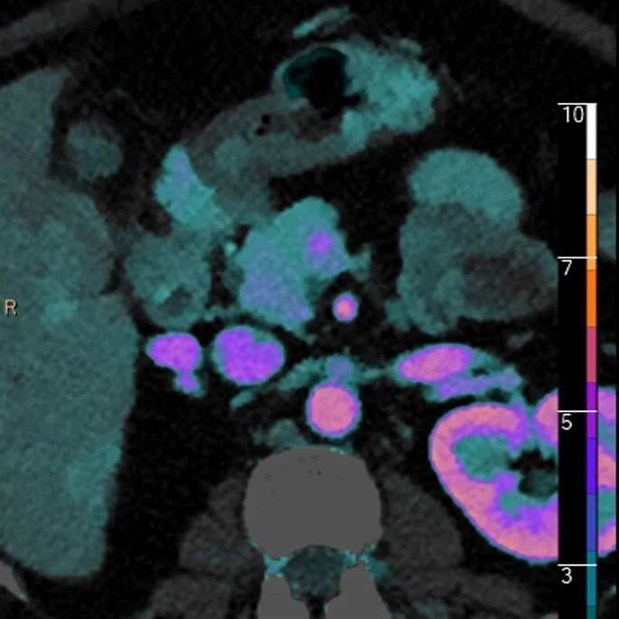 Hiding in plain sight