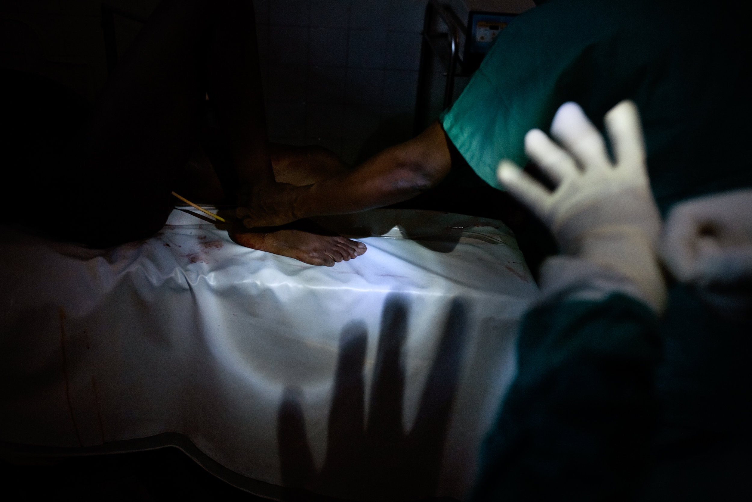  A surgical team performs a c-section during a power cut in Abobo Sud Hospital in Abidjan, Ivory Coast, April 18, 2011. A week after the end of the military standoff in Abidjan, very few hospitals were open. 